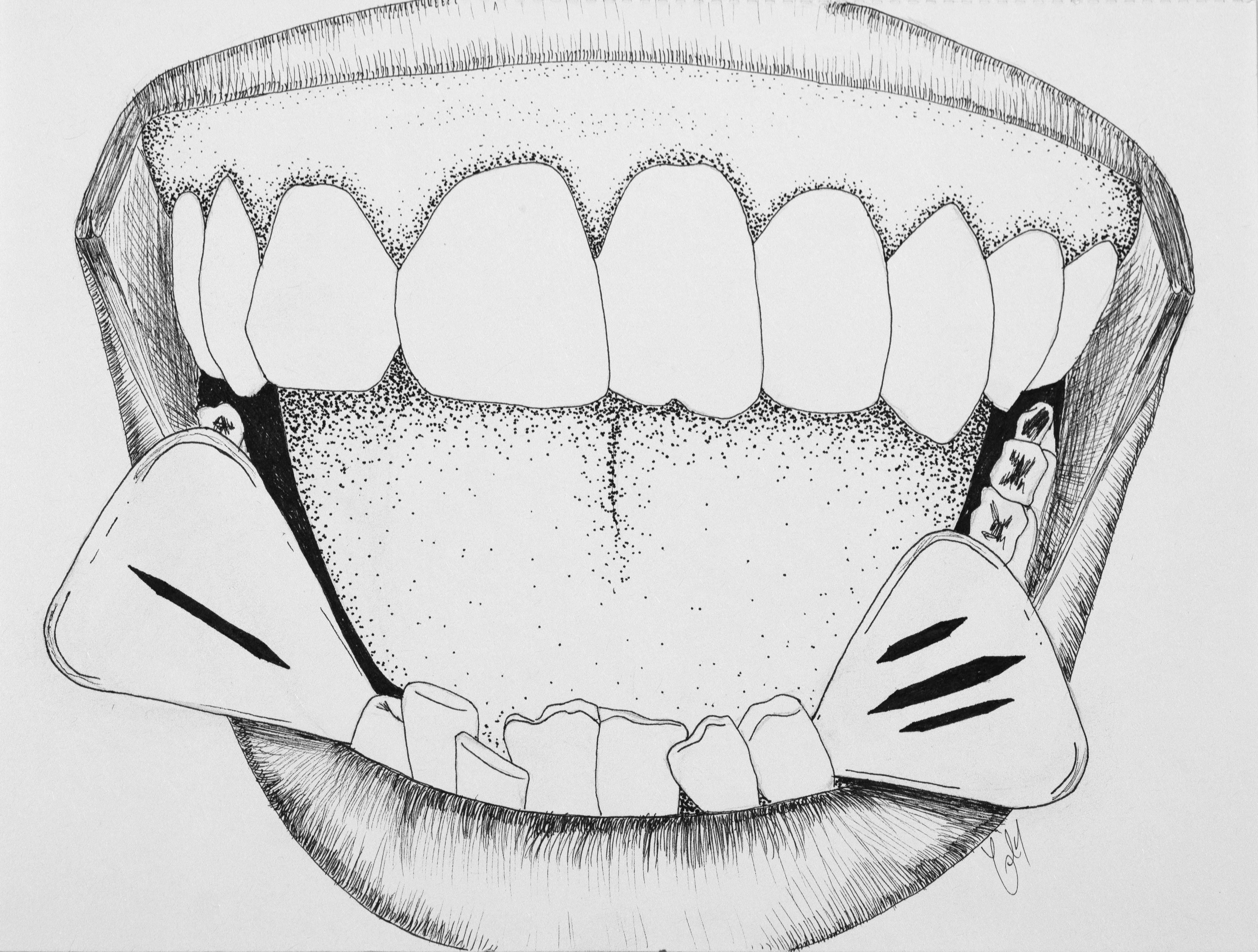 An ink draw mouth opens wide to show it's teeth with guitar picks stuck between